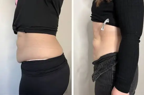 Weight Loss Journey - 3 Month Results