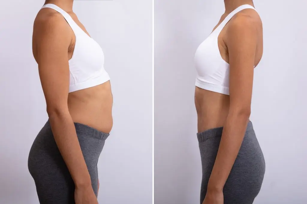 Before & After