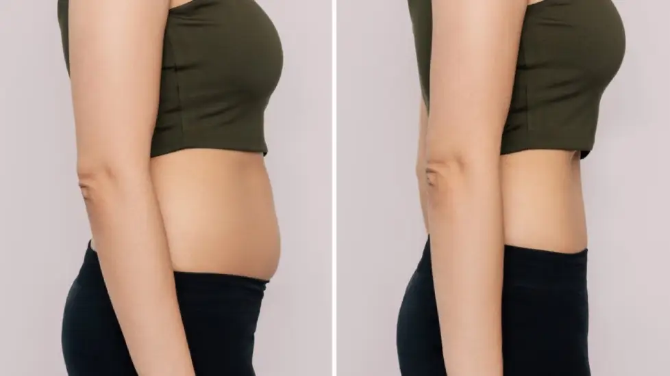 Before & After